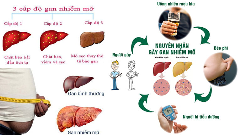 Phụ Kiện Sức Khoẻ